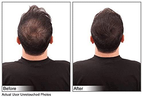 (Black) Hair Building Fibers Instantly Conceal Thinning Hair and Bald Spots for Men & Women (Large 28 Grams Bottle) - Undetectable, Washes Away, For All Hair Types, No Animal Byproducts