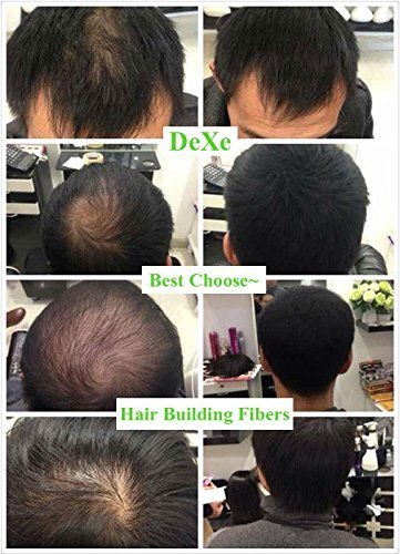 Dexe - Easy to Use Lose Hair Building Fibers Medium Brown Color 22g