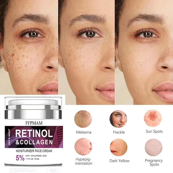Retinol Cream for Face Anti Aging: Wrinkle Cream for Face Neck with Collagen Hyaluronic Acid - Night Moisturizer for Men Women - Facial Skin Care(1.7FL.Oz)