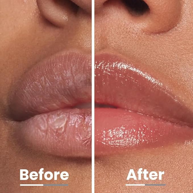 VS All I Need Lipscreen with SPF 30 & 2% Kojic Acid - Moisturizing, Sun Protection | Hyphen | Smooth Lips, Tan Removal for Women and Men | Lip Balm SPF | Chapped Dry Lips | Peptide- 10 gm