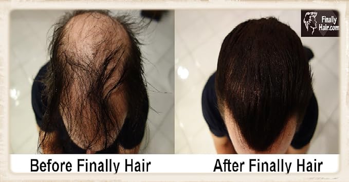 Hair Building Fibers Dark Grey 25 Grams Refill Your Existing Bottle. Highest Grade Fiber by Finally Hair (Dark Gray)