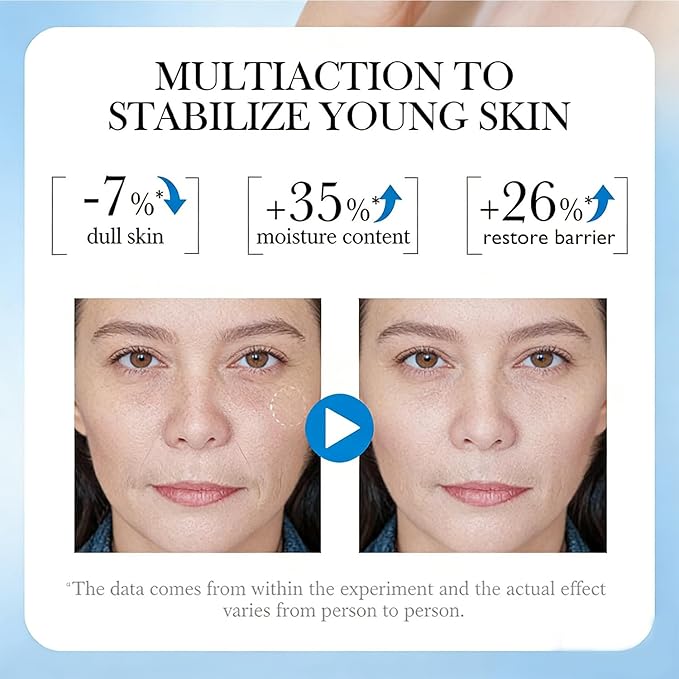 Collagen & Retinol Face Cream - 7% Hydrating Complex Anti Aging & Wrinkle Moisturizer, Firming Cream with Advanced Moisture Lock, Day & Night Face Cream for Women & Men, 1.75oz