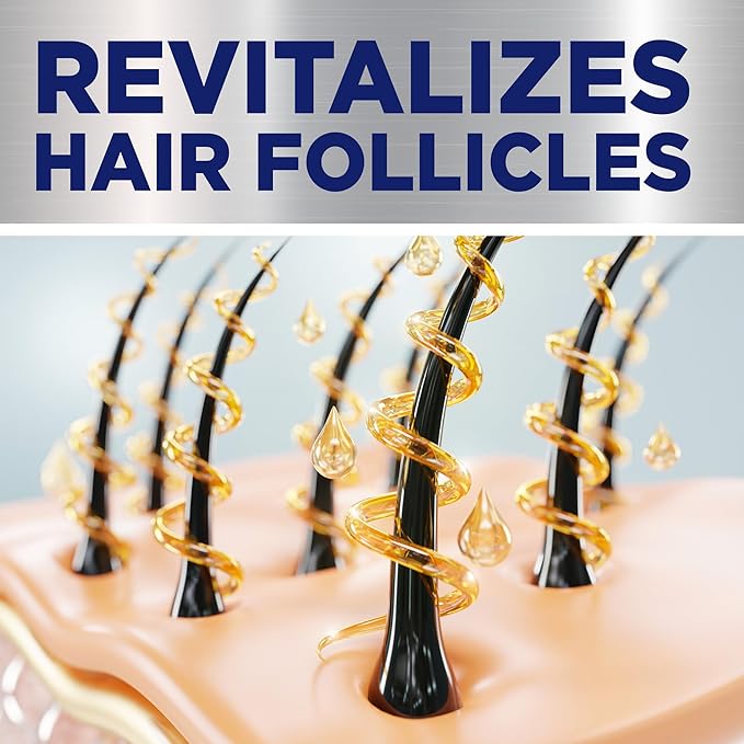 Minoxidil Topical Solution, 2 Percent, Hair Regrowth Treatment For Women
