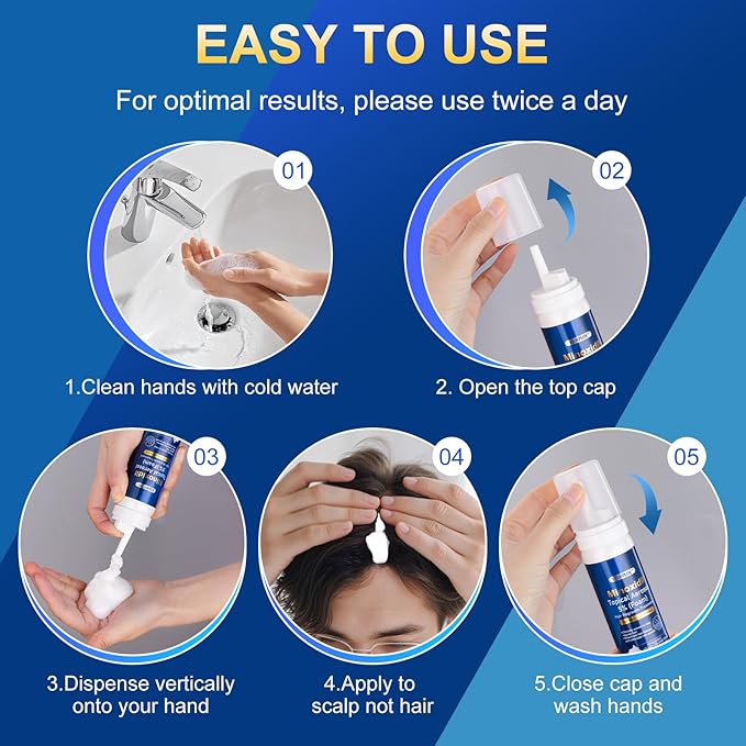 5% minoxidil foam for men-5pack, Infused with Biotin, Hair Growth Treatment, Supports Thicker and Fuller Hair & Beard (10.5oz, 5 Month Supply)