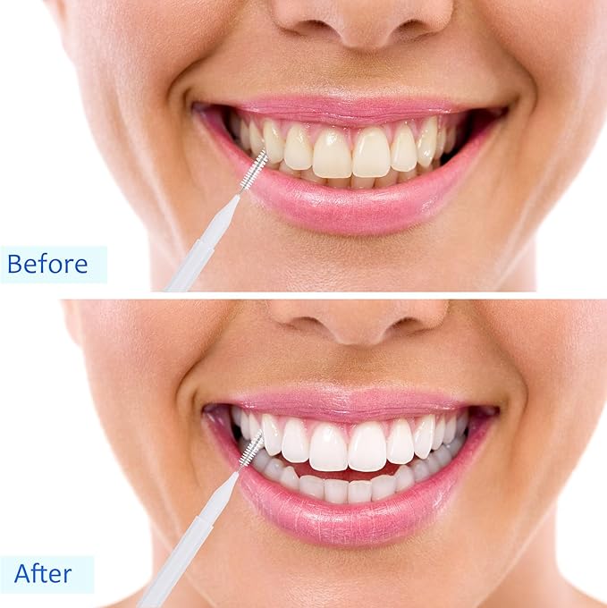 Patelai 50 Pieces Interdental Brush for Cleaner Braces Brush Toothpick Dental Tooth Flossing Head Oral Dental Hygiene Flosser Toothpick Cleaners Tooth Cleaning Tool (Black, White, Gray)
