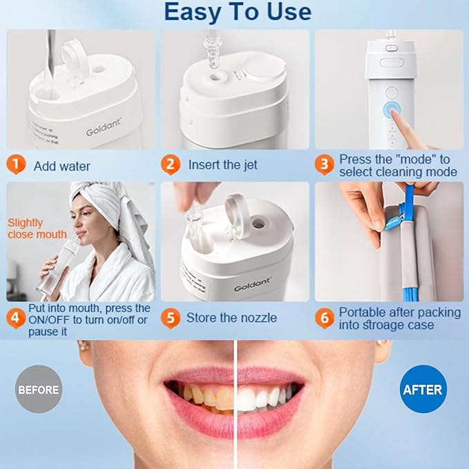 2026 New Portable Water Flosser for Teeth, 4 Modes & 4 Intensity Levels, Mini Small Design with Exquisite Travel Case, Removable Tank, IPX7 Waterproof, Cordless Dental Oral Irrigator (Black)