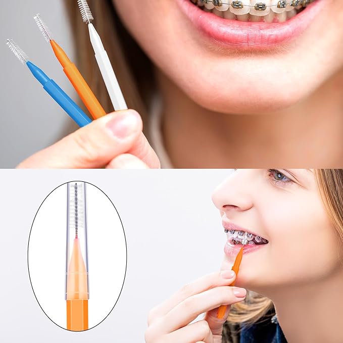 Patelai 100 Pieces Braces Brush for Cleaner Interdental Brush Toothpick Dental Tooth Flossing Head Oral Dental Hygiene Flosser Toothpick Cleaners Tooth Tool(White, Orange, Blue,Proper Size)