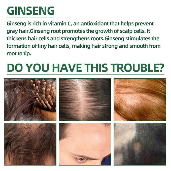 Rosemary Biotin Hair Growth Spray with Ginseng & Ginger - Hair Tonic for Scalp Nourishment, Hairfall Control, Natural Follicle Strengthener, Vegan Formula (1 pcs)