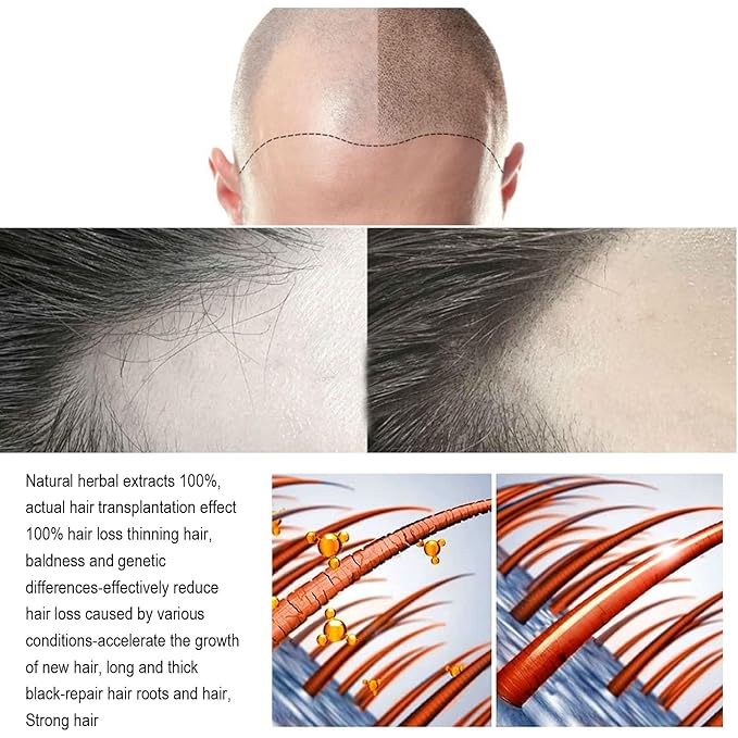 Hair Regrowth System, Advanced Hair Growth Treatment Ginseng, Eclipta Prostrata, Peppermint Oil and Ginger Root, Treatment for Thicker, Strengthens Roots,for Men and Women 1pcs