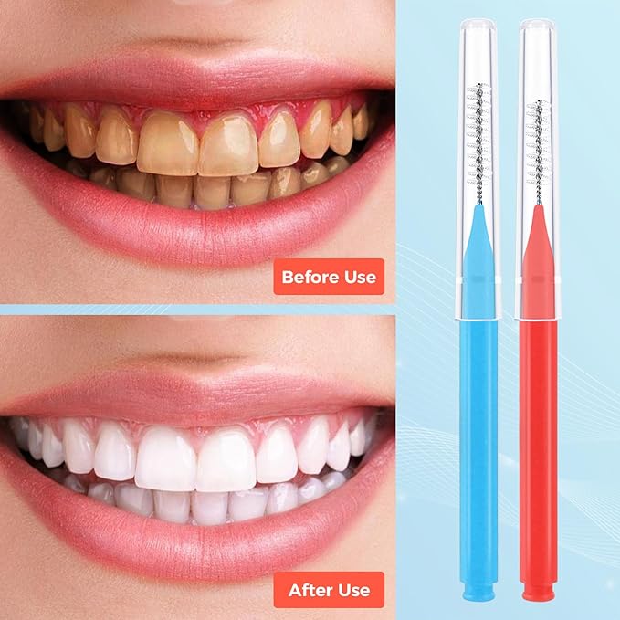 100 Pcs Interdental Brushes, 2 Sizes Braces Flossers for Cleaner Braces Brush Soft Dental Brushes Toothpicks Dental Floss Picks Dental for Braces Oral Cleaning(Red,Blue)