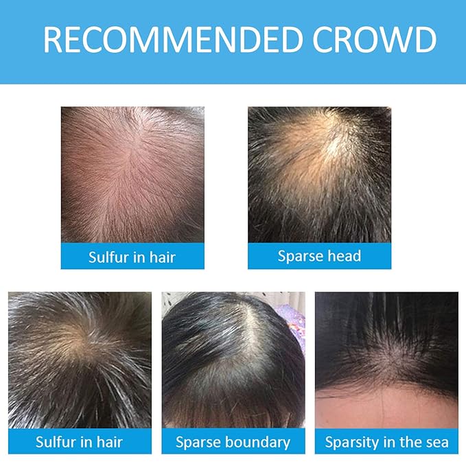 Hair Fibers for Thinning Hair, Natural Formula Hair Fiber, Hair Building Fibers Refill Thicker Hair in 15 Seconds, Conceals Hair Loss & Look Younger, Designed for Men & Women (Light Brown)
