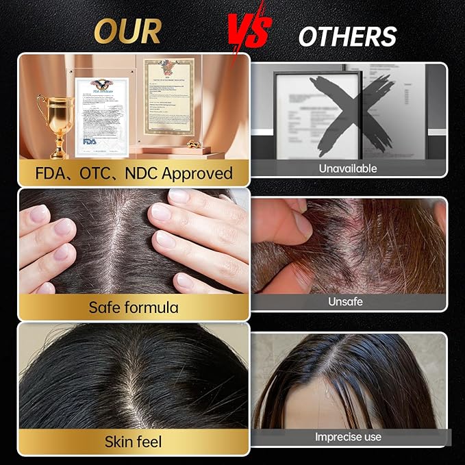 Minoxidil for Men & Women, With Biotin, Batana Oil, Rosemary Essential Oil, Effective Hair Loss Solution, Hair Loss Treatment for Hair Regrowth, Non-Greasy 5% Minoxidil - 60ml(Serum + Massager Set)