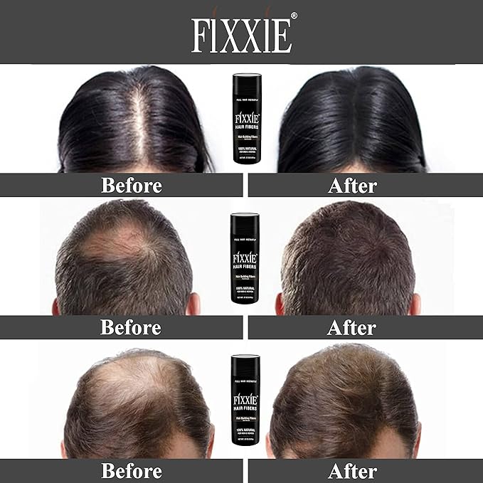 Hair Building Fibers BLACK for Thinning Hair 27.5g Bottle, Hair Fibre Concealer for Hair Loss for Men and Women, Naturally Thicker Looking Hair with Keratin Hair Fibers