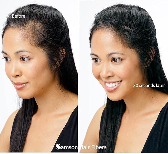for Thinning Hair - 100% Undetectable Natural Formula - Completely Conceals Hair Loss in Seconds. Covers bald spots. Thicken your hair instantly - 25 Grams Refill (WHITE)
