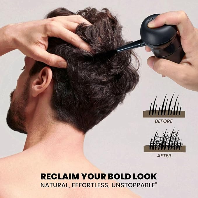 Hair Building Fibers Kit for Thinning Hair, Hair Thickening Fiber & Hold Spray for Instant Natural Finish, Long-Lasting Coverage, Conceals Sparse Roots & Hairline- Dark Brown, 30g+120ml