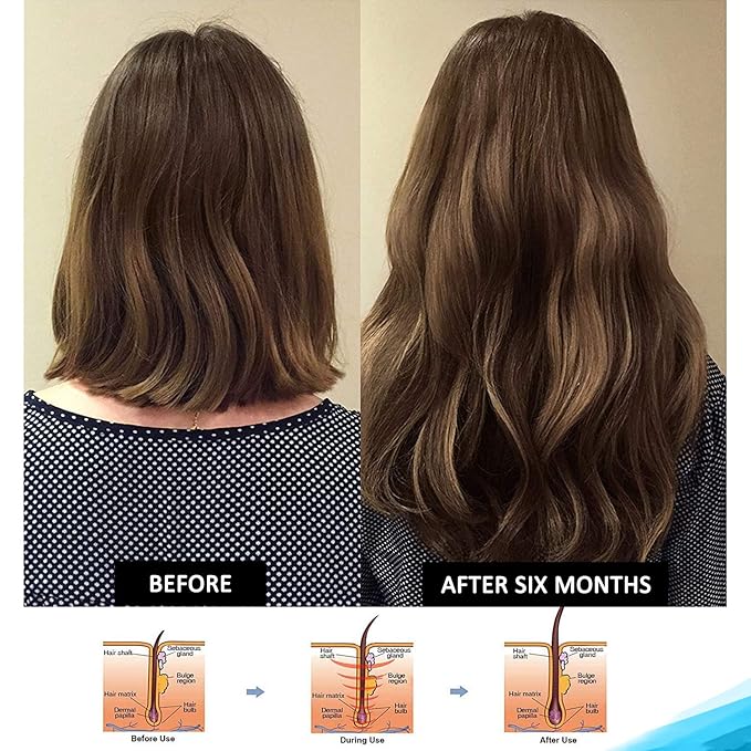 Hairgenics Pronexa Clinical Strength Hair Growth & Regrowth Therapy Hair Loss Shampoo With Biotin, Collagen, and DHT Blockers for Thinning Hair, 8 fl. oz.