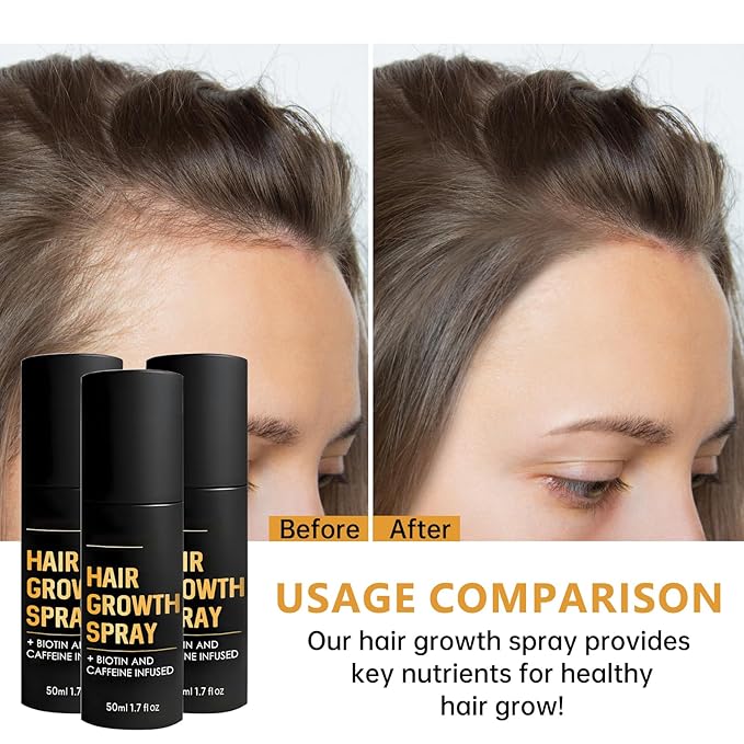 5% Minoxidil Hair Growth Spray for Fuller Hair, Enhance Hair Vitality & Shine, Suitable for All Hair Types For Women & Men, 1.7floz/50ml