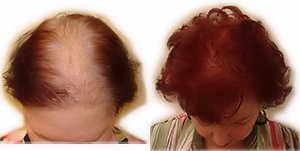 Finally Hair Fibers Refill Bag - 56 Grams of Premium Hair Loss Concealer in a Refill Bag (Light Medium Blonde)