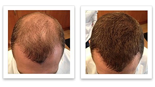 Caboki Hair Fibers for Thinning Hair – Natural Plant-Based Hair Powder for Men & Women – Instantly Thicker Fuller Looking Hair – Wind & Sweat Resistant – 30g, 90-Day Supply, Auburn