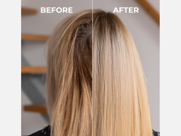 MOEV ANNURCATIN Shampoo | Korean Apple Hair Care for Strength and Volume in Thinning Hair | Adds Lift | Paraben-Free | Suitable for All Hair Types (10.14 fl.oz, Apple & Vanilla)