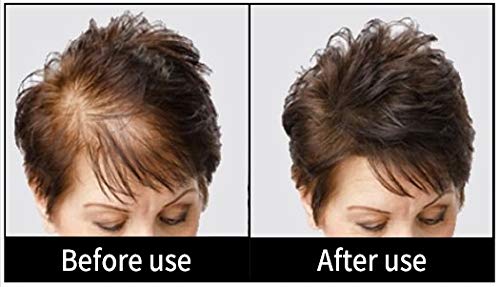 Volumizing Hair Fibers with real Keratin for Thinning Hair/Hair Loss – Dermatologist Tested and Certified Hypoallergenic - 60 days + supply - Multiple Colors Available (Black)