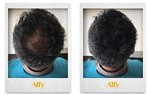 Alfy Hair Building Fibers for Thinning Hair, Medium Blonde, 5g
