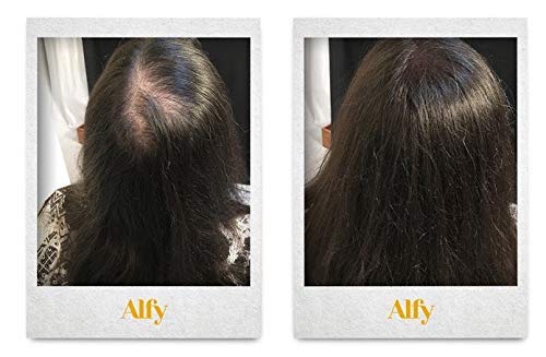 Alfy Hair Building Fibers for Thinning Hair, Auburn, 12g