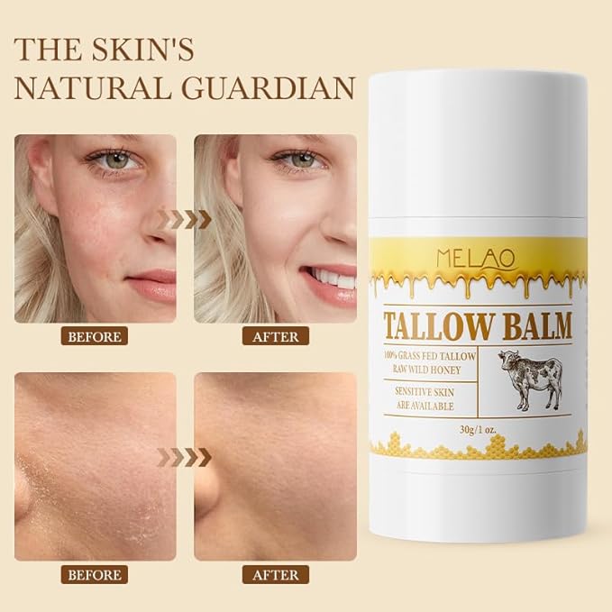 Tallow Balm Stick - Multi-Purpose Moisture Stick for Face & Body, Tallow and Honey Balm for Dry Skin, Lips & Cuticles, Soothing & Hydrating, Beef Tallow Moisturizer