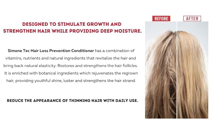 Simone Tec Prevention Hair Loss Conditioner 8Fl Oz | Restore and Strengthen Formula, Scalp Circulation Stimulator | Dx2-Dixidox Phase 1 and DNA-Pollen Phase 2 10ml Promo Included