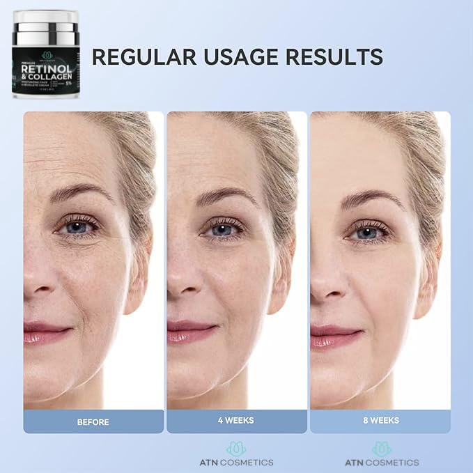 Retinol Cream for Face & Neck, Collagen Moisturizer, Day & Night Cream for Women & Men, Anti Aging, Wrinkle Cream with Hyaluronic Acid, Made in USA