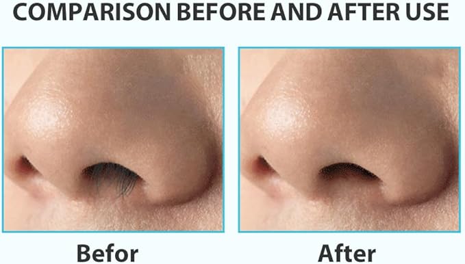12pcs Nasal Hair Cutter,Double Sided Nose Hair Cutter, Portable 360° Rotating Manual Nose Hair Trimmer for Men and Women