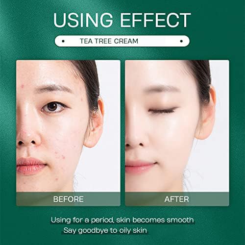 AKARY Tea Tree Oil Face Cream for Oily Skin, Extra Soothing & Nourishing Non-Greasy Facial Moisturizer, Gently Repair For Dry Skin, Balancing Oily Skin Moisturizer - Non-Greasy Moisturizer