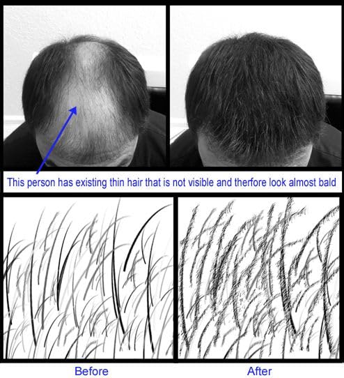 Hair Building Fibers, 28g - for Thinning Hair Instantly Thicker, Complete Looking Hair 6 Shades for Men Women (Light Blond)