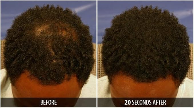 Dr. Yates MD Keratin Fiber Hair Enhancer (Medium Brown)