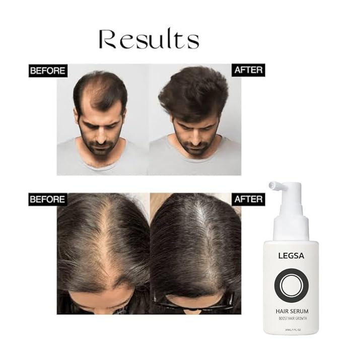 Hair Growth Serum Concentrate - Rosemary, Redensyl, Anagain, Baicapil, Caffeine, Plant Keratin & Rice Water