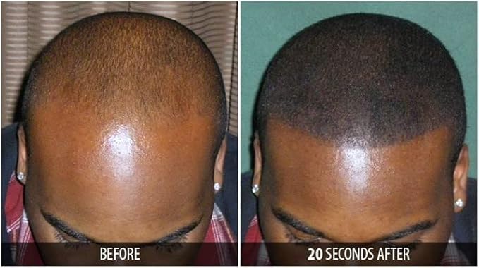 Dr. Yates MD Keratin Fiber Hair Enhancer (Light Blonde)