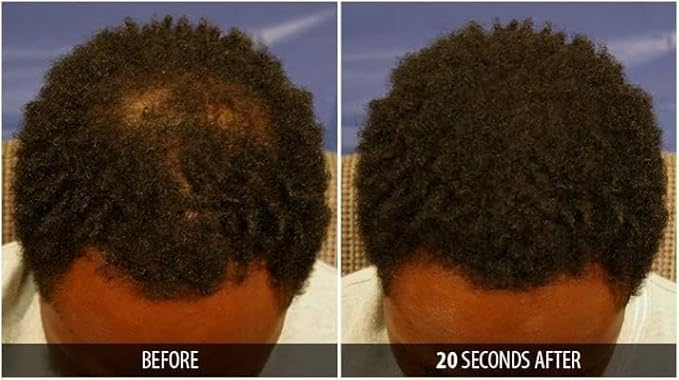 Dr. Yates MD Keratin Fiber Hair Enhancer (Light Brown)