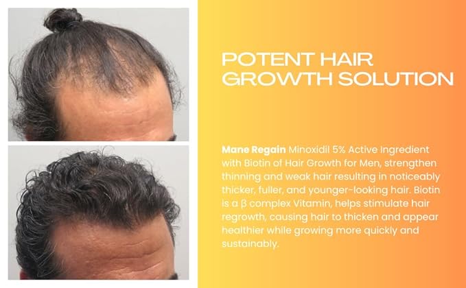 Minoxidil Topical Solution USP 5%, Extra Strength Hair Regrowth Treatment for Men, 2 Month Supply, Unscented, 4 Fl Oz (2 Pack)