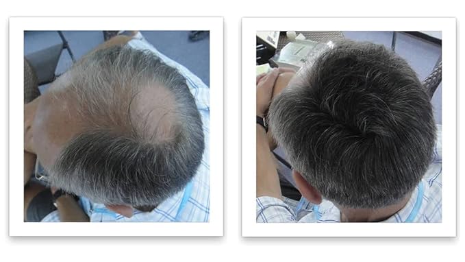 Caboki Hair Loss Concealer (All-Natural Hair Building Fibers) Travel Size. (Dark Gray)