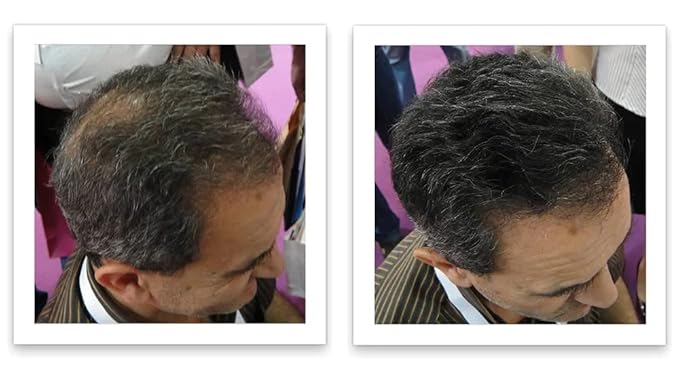 Caboki Hair Building Fiber + Built-in Spray Applicator (30-50 Days Supply). Salt & Pepper Dark