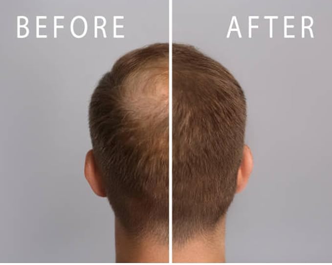 Hair Growth for Men and Women-Z-LAB27™ BioActive Plant Formula Awakens Hibernating Roots-Stimulates and Nourishes Scalp-Blocks DHT-Fuller Thicker Hair-Made in USA