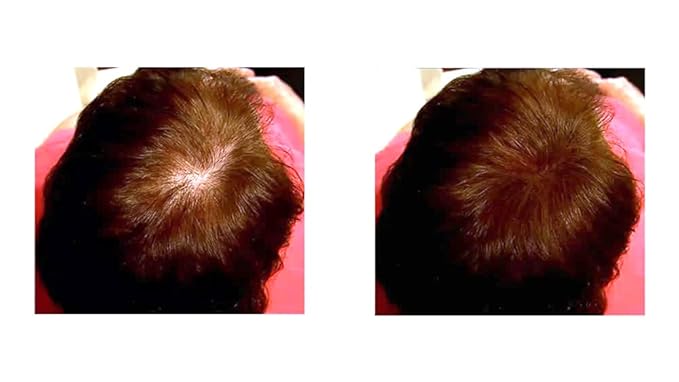 Caboki Hair Building Fiber + Built-in Spray Applicator (30-50 Days Supply). Auburn