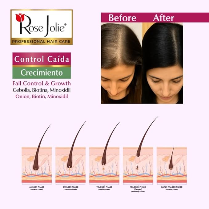 Rose Jolie Onion & Biotin Hair Tonic Spray | Fall Control & Growth Support | Strengthens Roots & Revitalizes Scalp | Sulfate-Free Salt-Free Paraben-Free | No Onion Smell | 9 fl oz