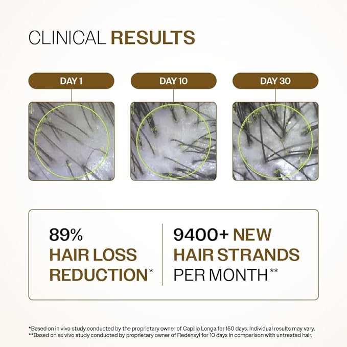 Bare Anatomy Advanced Hair Growth Serum| 3% Redensyl - 2x Better Results than Minoxidil | + 4% Anagain + 3% Baicapil | Rosemary, Biotin | Hair growth & Hair fall control serum for Women & Men | 30mL