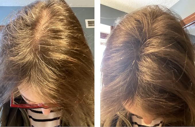 Caboki Hair Fibers for Thinning Hair – Natural Plant-Based Hair Powder for Men & Women – Instantly Thicker Fuller Looking Hair – Wind & Sweat Resistant – 30g, 90-Day Supply, BLONDE