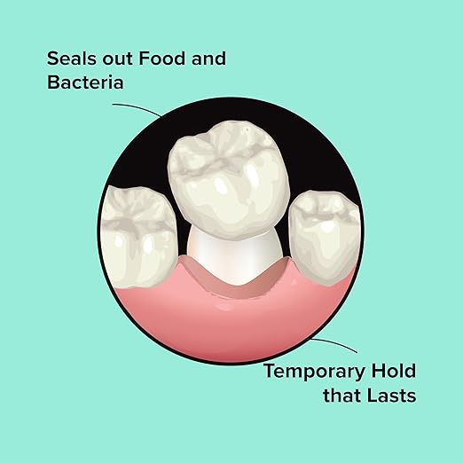 Dentemp Recap-It Cap and Crown Repair Dental Kit - Fast Acting Formula Dental Cement for Loose Caps (Pack of 1) - Temporary Cement for Crown and Bridge