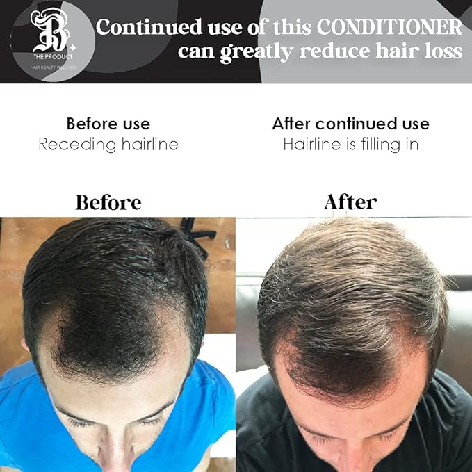 Biotin Vitamin Hair Conditioner for Thinning Hair - Moisturizing Conditioner with Aloe Vera and Cucumber Conditioning Treatment for Dry and Damaged Hair B THE PRODUCT 8.5oz