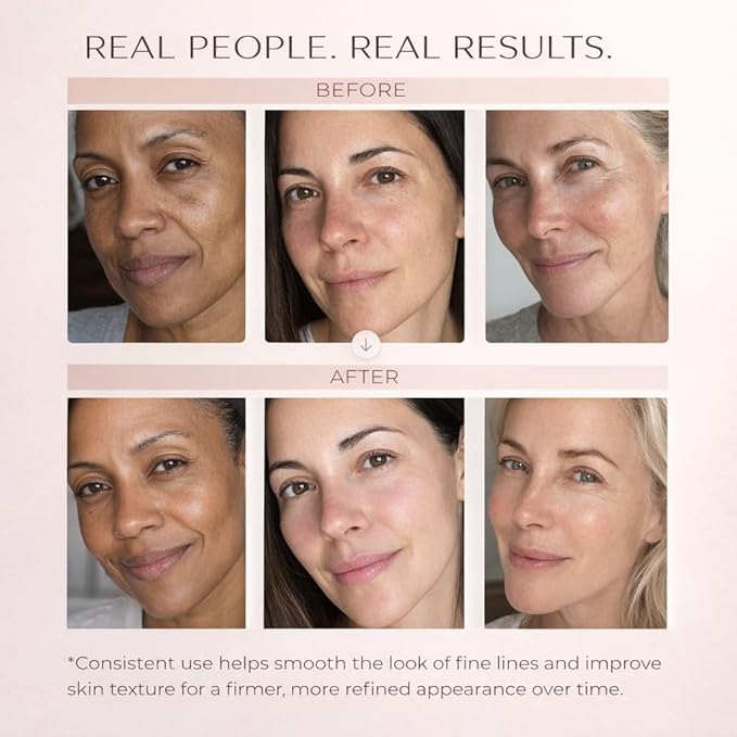 Wrinkle Cream For Face- Anti-Aging Moisturizer- Retinol Collagen Face Cream w/Hyaluronic Acid – Hydrating Firming Cream for Fine Lines and Deep Wrinkles- Day & Night Use for Women and Men- 4oz Jar.