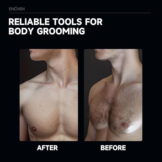 Enchen 4-in-1 Electric Body Hair Trimmer for Men - Ball Trimmer with Replaceable Ceramic Blades | USB Rechargeable, IPX7 Waterproof | Painless Pubic, Face, Underarm & Leg Grooming Tool