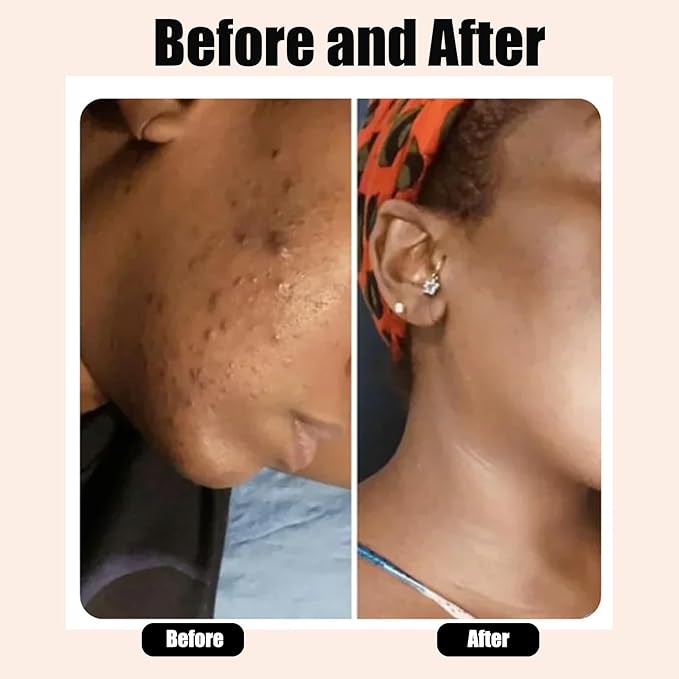 African Black Soap– Raw African Black Soap Bar Moroccan Black Soap Hydrates Dry Skin for All Skin Types, Supports a More Even-Looking Skin Tone for Face & Body Wash